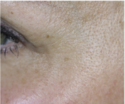 Soin Jeunesse Des Yeux