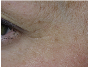Soin Jeunesse Des Yeux